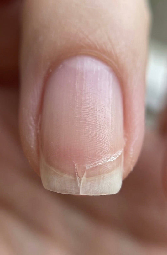 Por qué tus uñas siempre se rompen "de lado"? El secreto microscópico que no conocías
